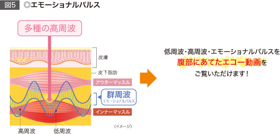 ◎エモーショナルパルス