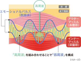 高周波 皮 膚 エモーショナルパルス （群周波） 皮下脂肪 …